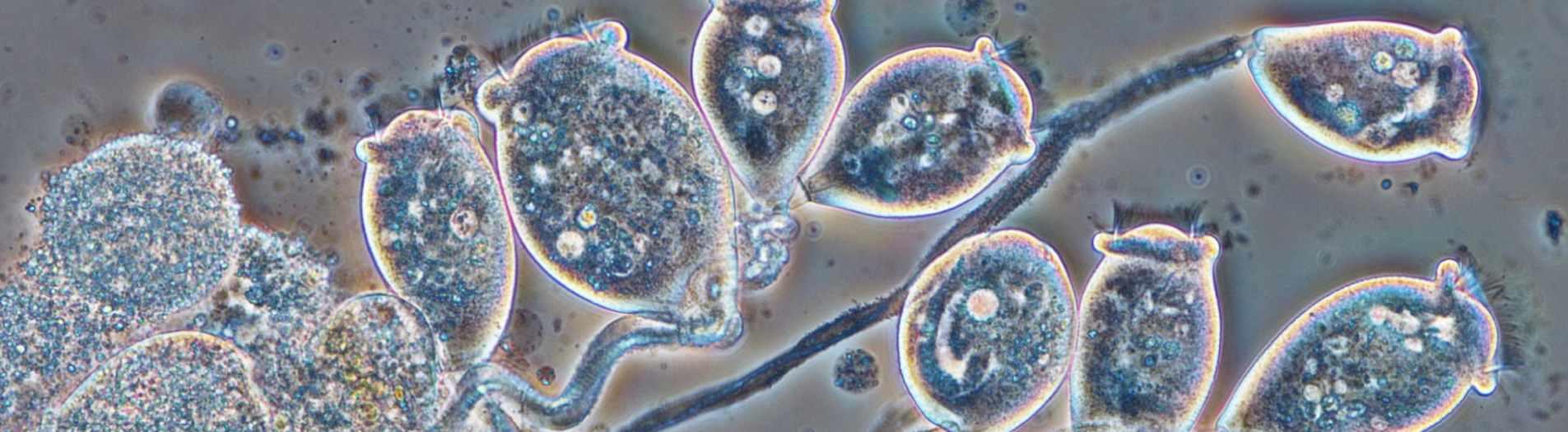 AnitaMox tehokas energiaa säästävä typenpoisto